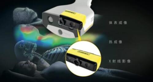 康耐视3D-A5060三维面阵视觉系统助力精准放疗，实现人体定位监控新维度